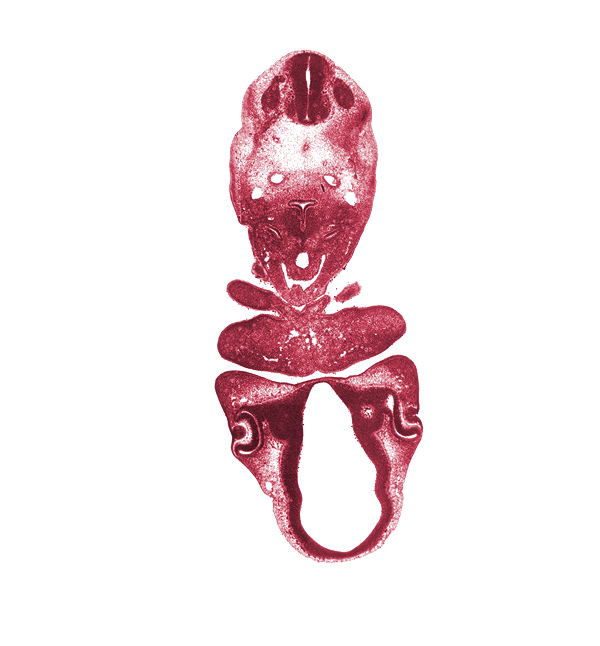 C-3 spinal ganglion, aortic sac, caudal edge of pharyngeal arch 2, corneal epithelium, dorsal aorta, dorsal thalamus, external layer of optic cup, intermediate zone, internal layer of optic cup, intraretinal space (optic vesicle cavity), lens pit, mandibular prominence of pharyngeal arch 1, marginal zone, maxillary prominence of pharyngeal arch 1, neural arch primordium, notochord, optic stalk (CN II), pericardial cavity, precardinal vein, pretectum, retinal fissure, sulcus medius, synencephalon, ventral thalamus, ventricular zone