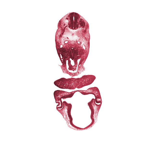 C-3 spinal ganglion, aortic sac, chiasmatic plate, diencoel (third ventricle), dorsal aorta, dorsal thalamus, epithelium of larynx, intraretinal space (optic vesicle cavity), junction of aortic sac and pulmonary arch, laryngeal condensation, lens pit, mandibular prominence of pharyngeal arch 1, maxillary prominence of pharyngeal arch 1, median mandibular groove, neural arch primordium, neural canal, notochord, optic stalk lumen (CN II), pericardial cavity, precardinal vein, sclerotome, sulcus medius, synencephalon, ventral thalamus