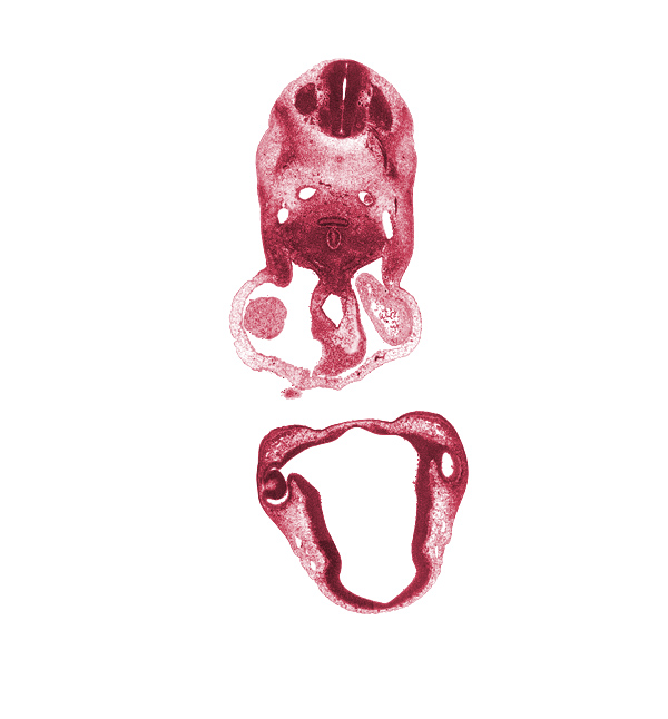 C-3 dorsal root, C-3 spinal ganglion, C-3 spinal nerve, C-3 ventral root, anterior dural venous plexus, chiasmatic plate, diencoel (third ventricle), dorsal aorta, dorsal thalamus, edge of left atrium, edge of mandibular prominence of pharyngeal arch 1, edge of right atrium, epithalamus, esophagus primordium, external layer of optic cup, internal layer of optic cup, intraretinal space (optic vesicle cavity), laryngeal condensation, maxillary venous plexus, mesocardium, notochord, optic stalk (CN II), optic stalk lumen (CN II), pericardial cavity, precardinal vein, spinal accessory nerve (CN XI), trachea, truncus arteriosus (outflow tract), ventral thalamus