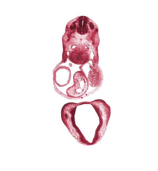 C-4 spinal ganglion, alar plate(s), basal plate, cephalic edge of sinus venosus, cerebral primordium (vesicle), cervical plexus, chiasmatic plate, conotruncal ridge(s), conus cordis (outflow tract), corpus striatum, dorsal aorta, edge of optic cup, epithalamus, esophagus primordium, floor plate, left atrium, left precardinal vein, medial nasal prominence(s), notochord, optic groove, pericardial cavity, right atrium, right precardinal vein, roof plate, sulcus limitans, trachea, truncus arteriosus (outflow tract)