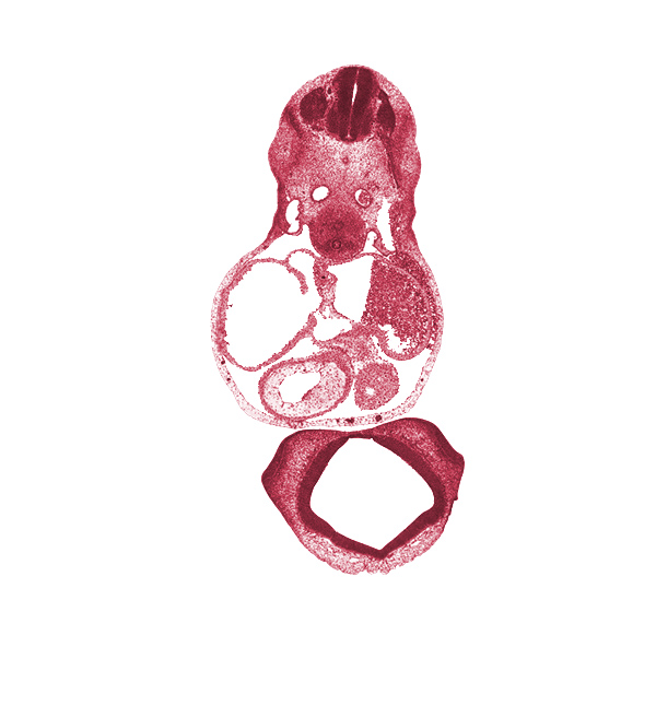 C-4 dorsal root, C-4 spinal ganglion, C-4 ventral root, cephalic part of shoulder region, cervical plexus, conus cordis (outflow tract), diencoel (third ventricle), dorsal aorta, esophagus primordium, lateral nasal prominence, lateral ventricle, left atrium, left common cardinal vein, left precardinal vein, left venous valve, left ventricle, medial nasal prominence(s), neural arch primordium, notochord, primary interatrial septum (septum primum), right atrium, right venous valve, sinus venosus, trachea