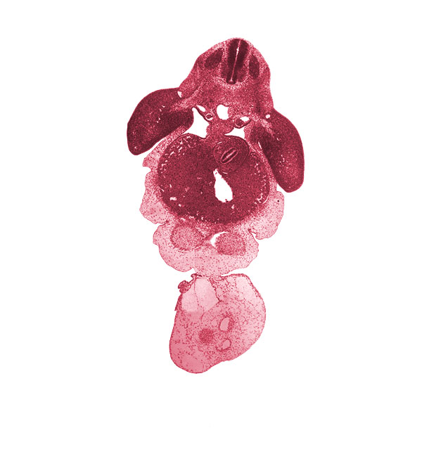 C-7 spinal ganglion, allantois, aorta, brachial plexus, caudal edge of left ventricle, caudal edge of pericardial cavity, caudal edge of right ventricle, cephalic recess of lesser sac (omental bursa), common umbilical vein, dorsal mesogastrium, ductus venosus, left umbilical artery, peritoneal cavity, postcardinal vein, right umbilical artery, septum transversum, stomach