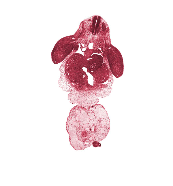 C-8 spinal ganglion, C-8 spinal nerve, C-8 ventral ramus, C-8 ventral root, allantois, amnion on surface of umbilical cord, caudal eminence, common umbilical vein, dorsal mesogastrium, ductus venosus, gall bladder primordium, intermediate zone, left umbilical artery, lesser  sac, marginal vein, marginal zone, mesonephric duct, neural tube, notochord, peritoneal cavity, post anal gut, right umbilical artery, septum transversum, spleen primordium, surface epithelium, upper limb, ventricular zone