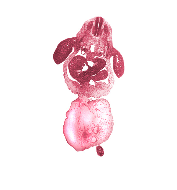 C-8 spinal ganglion, amnion on surface of umbilical cord, bile duct, caudal eminence, coccygeal somites, common umbilical vein, dorsal mesentery, hepatic duct(s), hepatic sinusoid, intermediate zone, junction of ductus venosus and left umbilical vein, junction of duodenum and stomach, junction of umbilical cord and ventral body wall, left lobe of liver, left umbilical artery, lesser  sac, marginal zone, mesonephric duct, mesonephric tubule(s), neural canal, neural tube, peritoneal cavity, post anal gut, right umbilical artery, septum transversum, umbilical coelom, umbilical cord, upper limb, ventricular zone