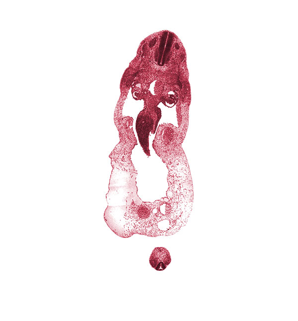 S-5 spinal ganglion, allantois, aorta, caudal part of T-1 spinal ganglion, common umbilical vein, dermatomyotome, dorsal mesentery, glomerulus, junction of peritoneal cavity and umbilical coelom, left umbilical artery, left umbilical vein, mammary crest, mesonephric duct, mucoid connective tissue, myotome, neural canal, neural tube, notochord, omphalomesenteric (superior mesenteric) vein, origin of mesonephric artery, peritoneal cavity, post anal gut, postcardinal vein, proximal limb of midgut loop, right umbilical artery, sclerotome, umbilical cord