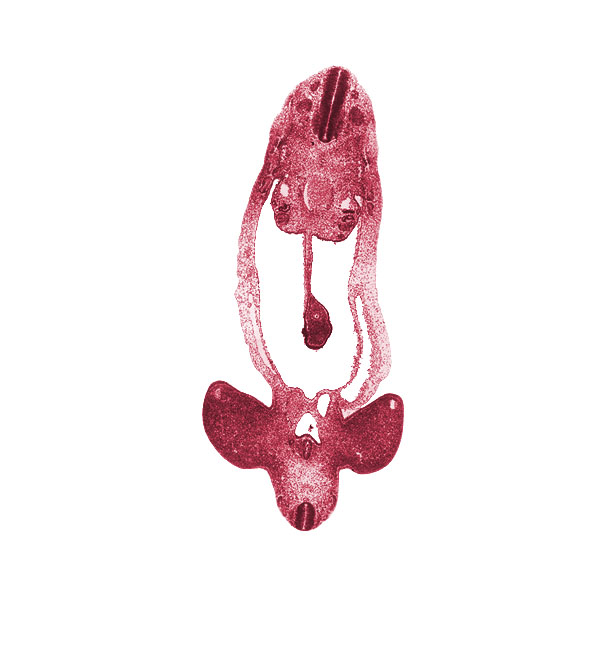 S-1 spinal ganglion, aorta, caudal part of T-3 spinal ganglion, cephalic part of T-4 spinal ganglion, cloaca, dorsal mesentery, hindgut, involuting right umbilical vein, junction of cloaca and mesonephric duct, left umbilical artery, left umbilical vein, limb mesenchyme, lower limb, marginal vein, mesonephric duct, mesonephros, midgut loop, neural canal, neural tube, notochord, right umbilical artery, sclerotome, somite remnant