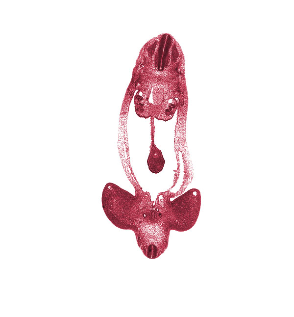 S-1 spinal ganglion, T-4 spinal ganglion, abdominal wall, alar plate(s), aorta, basal plate, dermatomyotome, dorsal mesentery, floor plate, gonadal ridge, hindgut, internal iliac artery, limb mesenchyme, lower limb, mesonephric duct, mesonephric tubule(s), mesothelium, midgut loop, notochord, peritoneal cavity, postcardinal vein, right umbilical artery, roof plate, sclerotome, sulcus limitans