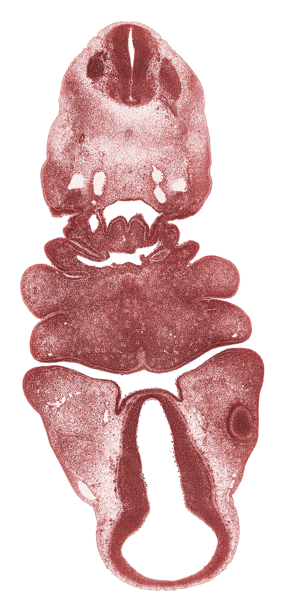 C-2 spinal ganglion, C-2 ventral root, adenohypophysial pouch, aortic arch 3, aortic arch 4, aortic sac, arytenoid swelling, diencoel (third ventricle), dorsal aorta, dorsal thalamus, hypothalamic sulcus, hypothalamus, inferior ganglion of vagus nerve (CN X), lateral lingual swelling of tongue, mandibular prominence of pharyngeal arch 1, maxillary prominence of pharyngeal arch 1, median mandibular groove, neural arch primordium, notochord, optic cup, oral fissure, pharyngeal arch 2, pharyngeal arch 3, pharyngeal arch 4, pharyngeal pouch 3, pretectum, sclerotome, spinal accessory nerve (CN XI), synencephalon, ventral thalamus