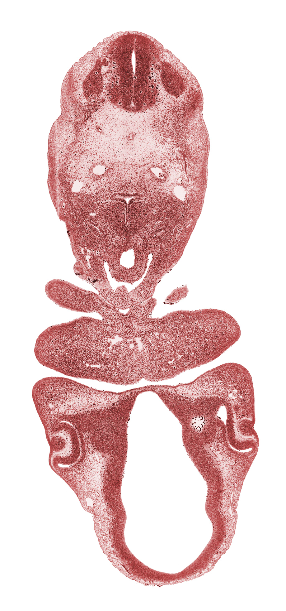 C-3 spinal ganglion, aortic sac, caudal edge of pharyngeal arch 2, corneal epithelium, dorsal aorta, dorsal thalamus, external layer of optic cup, intermediate zone, internal layer of optic cup, intraretinal space (optic vesicle cavity), lens pit, mandibular prominence of pharyngeal arch 1, marginal zone, maxillary prominence of pharyngeal arch 1, neural arch primordium, notochord, optic stalk (CN II), pericardial cavity, precardinal vein, pretectum, retinal fissure, sulcus medius, synencephalon, ventral thalamus, ventricular zone