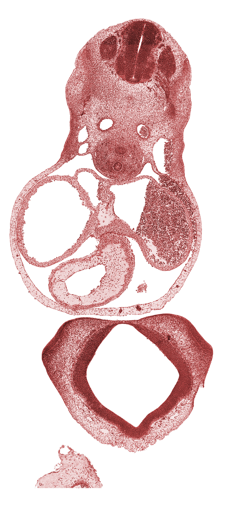C-4 spinal ganglion, C-4 spinal nerve, C-4 ventral root, cephalic edge of left ventricle, cerebral primordium (vesicle), conus cordis (outflow tract), diencoel (third ventricle), dorsal aorta, left atrium, left venous valve, nasal disc (olfactory placode), notochord, olfactory area, pericardial cavity, pericardial sac, precardinal vein, primary interatrial septum (septum primum), right atrium, sinus venosus, truncus arteriosus (outflow tract)