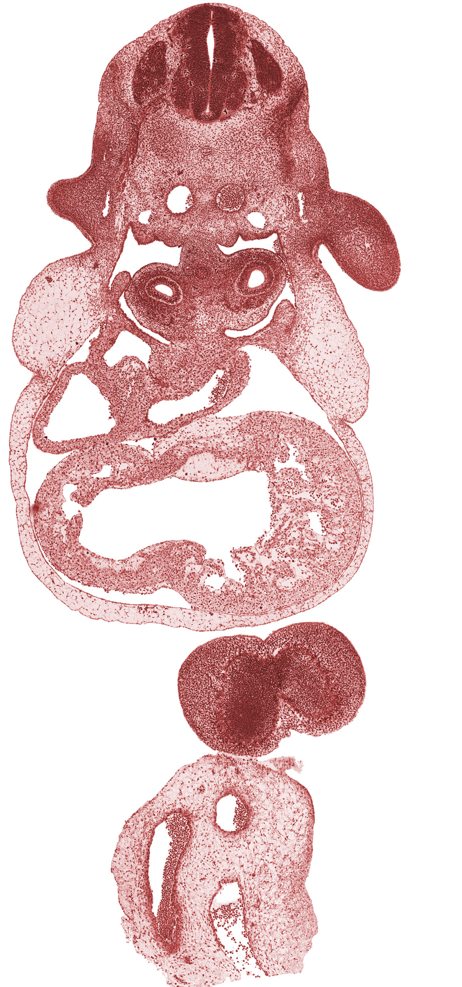 C-6 spinal ganglion, cephalic end of gonadal ridge, dorsal aorta, edge of telencephalon, frontal prominence, interventricular foramen, junction of left common cardinal vein and sinus venosus, left primary bronchus, left ventricle, notochord, pericardial cavity, pericardial sac, pleuropericardial membrane, postcardinal vein, right atrium, right common cardinal vein, right primary bronchus, right ventricle, shoulder region, upper limb