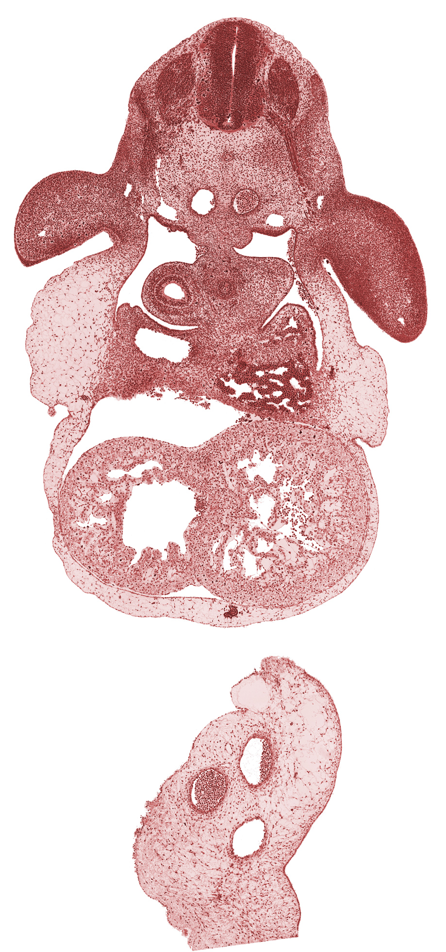 C-6 spinal ganglion, anterior interventricular groove, cephalic edge of liver, dorsal aorta, dorsal meso-esophagus, dorsal root(s), esophagus primordium, inferior vena cava, interventricular septum, left ventricle, notochord, pericardial cavity, pleuroperitoneal canal (pleural cavity), postcardinal vein, posterior interventricular groove, right lung sac, right ventricle, septum transversum, upper limb, ventral root