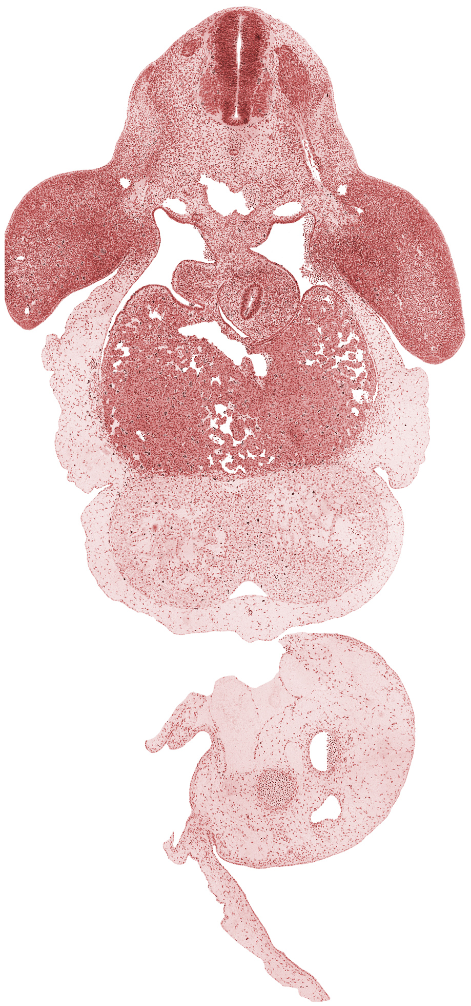 C-7 spinal ganglion, C-7 spinal nerve, amnion attachment, anterior interventricular groove, blastema of proximal humerus, brachial plexus, caudal edge of right lung sac, cephalic end of mesonephros, cephalic recess of lesser sac (omental bursa), common umbilical vein, intermediate zone, interventricular septum, junction of dorsal aortas, junction of ductus venosus and inferior vena cava, left umbilical artery, left ventricle, marginal zone, neural canal, notochord, pericardial sac, peritoneal cavity, postcardinal vein, posterior interventricular sulcus, right umbilical artery, right ventricle, stomach, sulcus limitans, umbilical cord, ventricular zone