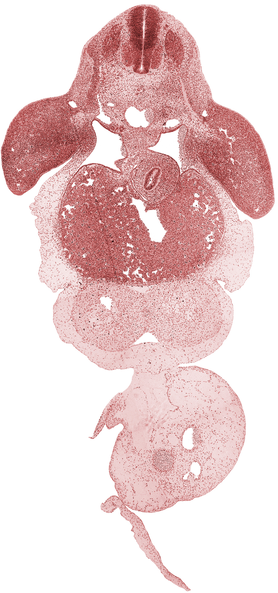 C-7 spinal ganglion, C-7 ventral ramus, allantois, aorta, apical ectodermal ridge, common umbilical vein, ductus venosus, junction of pericardial sac and umbilical cord, left umbilical artery, left ventricle, liver, peritoneal cavity, right umbilical artery, right ventricle, stomach, upper limb