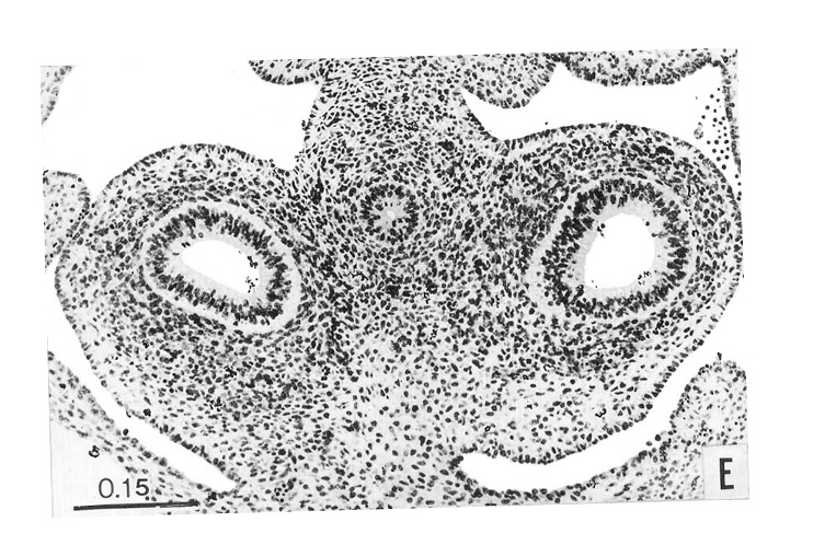 Section through the pulmonary region - Figure