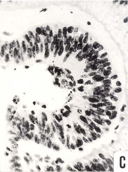 Section through the lens - Figure