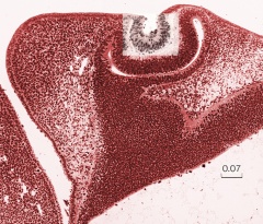 Section through the lens - Overlay