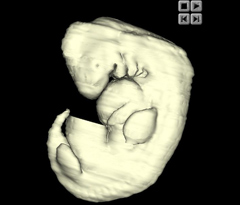 Embryo