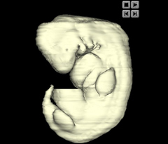 Embryo