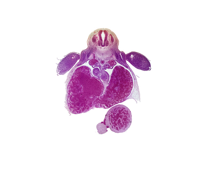 T-1 spinal ganglion, caudal edge of right lower secondary bronchus bud, caudal edge of right ventricle, central canal, ductus venosus, esophagus, left ventricle, liver, mesonephric duct