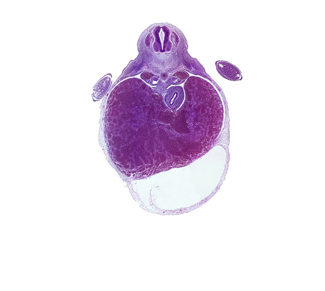 apical epidermal ridge, central canal, cephalic edge of T-2 spinal ganglion, ductus venosus, hand plate, liver, marginal vein, neural arch blastema, pericardial cavity, pericardial sac, right hepatic vein, septum transversum, stomach, upper limb