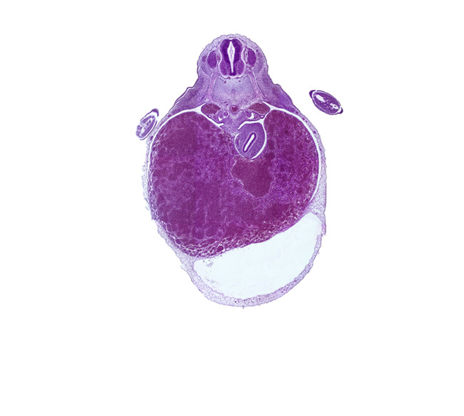 T-2 spinal ganglion, apical epidermal ridge, ductus venosus, hepatic sinusoid, marginal vein, mesonephric duct, neural arch blastema, pericardial cavity, pericardial sac, septum transversum, spinal nerve(s)