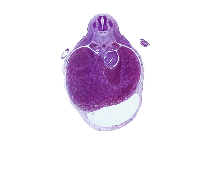 T-2 spinal ganglion, aorta, caudal end of upper limb, dorsal mesogastrium, ductus venosus, left hepatic vein, liver, myotome, notochord, pericardial cavity, pericardial sac, peritoneal cavity, septum transversum, stomach