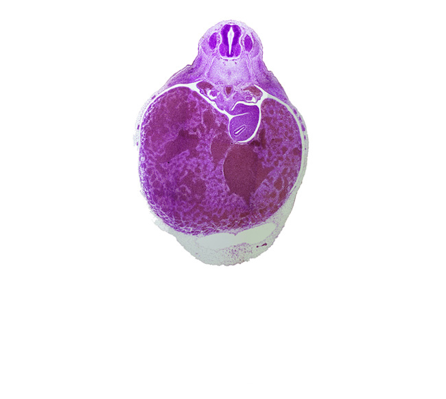 T-3 spinal ganglion, caudal edge of pericardial cavity, ductus venosus, omental foramen, postcardinal vein, splanchnic mesoderm, spleen primordium, stomach endoderm, suprarenal gland primordium