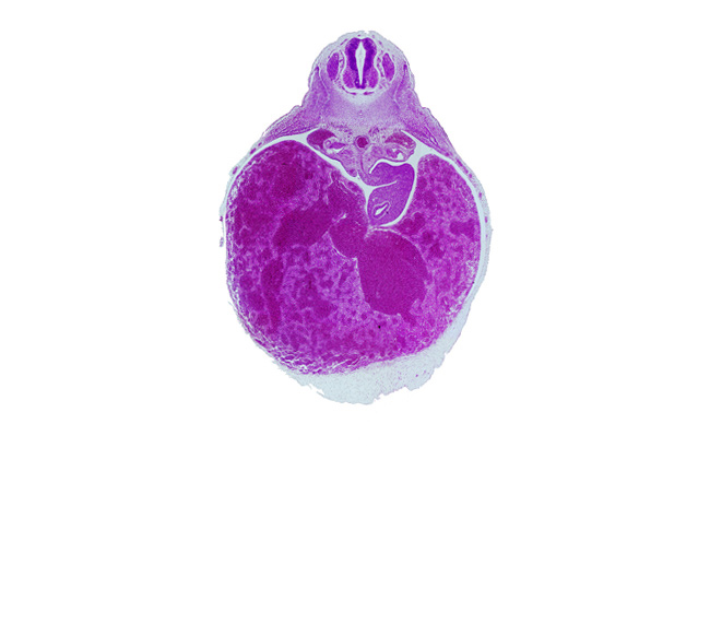 T-3 spinal ganglion, aorta, celiac artery, dorsal mesogastrium, ductus venosus, liver, neural arch blastema, postcardinal vein, stomach, suprarenal gland primordium, vertebral centrum blastema