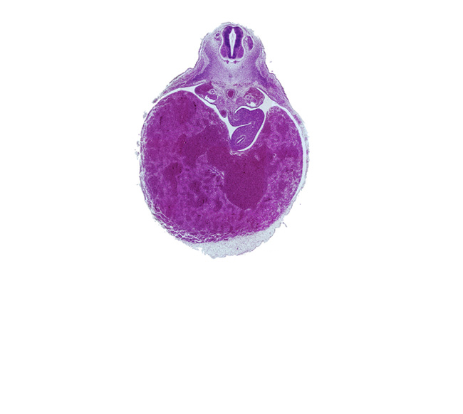 T-3 spinal ganglion, aorta, ductus venosus, greater sac, junction of duodenum and stomach, lesser sac (omental bursa), liver, neural arch blastema, omental foramen, postcardinal vein, rib blastema, spleen primordium, ventral body wall