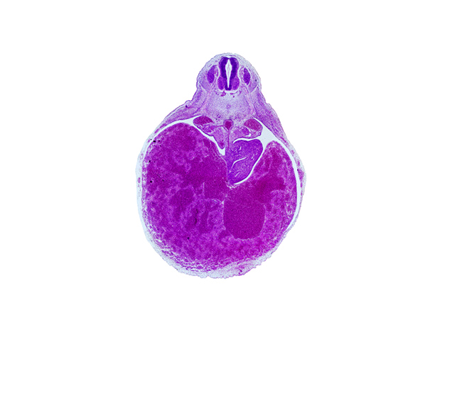 T-4 spinal ganglion, aorta, caudal edge of lesser sac (omental bursa), ductus venosus, duodenum, liver, mesonephric artery, notochord, postcardinal vein