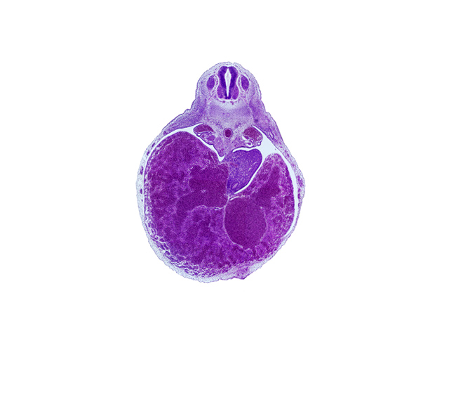 T-4 spinal ganglion, alar plate(s), aorta, basal plate, ductus venosus, duodenum, floor plate, liver, mesonephric duct, mesonephros, peritoneal cavity, postcardinal vein, roof plate, sulcus limitans, ventral body wall