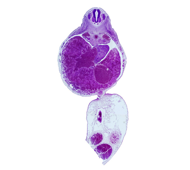 T-4 spinal ganglion, aorta, ductus venosus, duodenum, junction of umbilical cord and ventral body wall, left umbilical artery, liver, mesonephros, postcardinal vein, right umbilical artery, umbilical coelom, umbilical vein