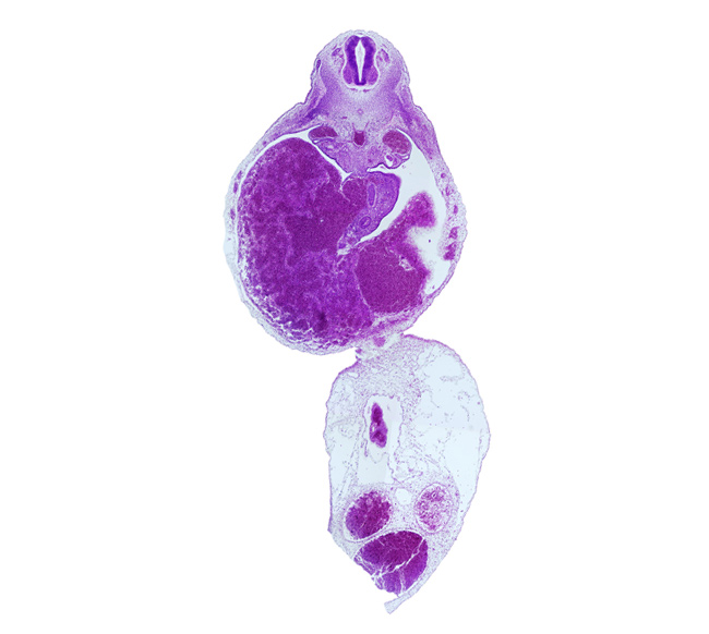 allantois, dorsal pancreatic bud, ductus venosus, duodenum, epaxial part of myotome, hypaxial part of myotome, left umbilical artery, liver, mesonephric duct, neural arch blastema, postcardinal vein, rib blastema, right umbilical artery, subcardinal vein, umbilical coelom, umbilical vein, umbilical vesicle stalk remnant