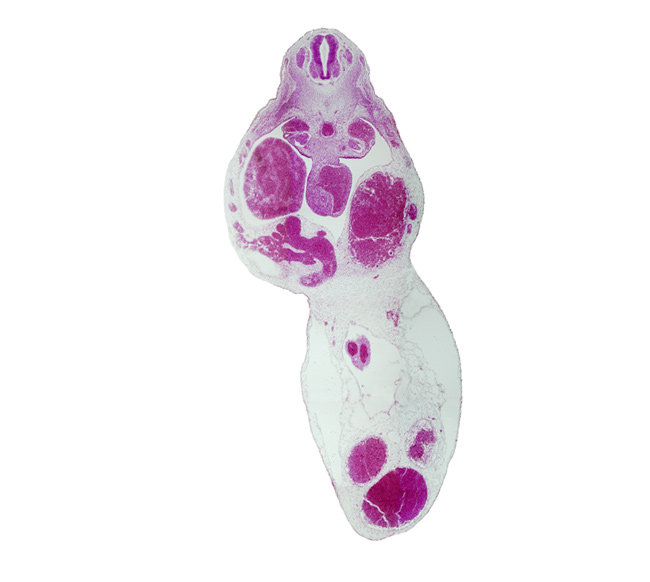 T-5 / T-6 interganglion region, aorta, cephalic edge of gonadal ridge, left umbilical artery, liver, midgut, right umbilical artery, umbilical vein, vitelline (omphalomesenteric) artery, vitelline (omphalomesenteric) vein