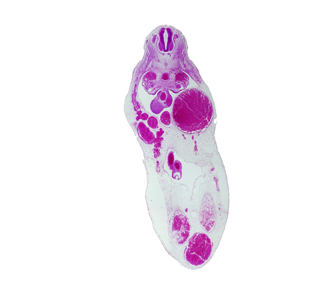 T-6 / T-7 interganglion region, allantois, aorta, gonadal ridge, left umbilical vein (congested), midgut, superior mesenteric artery, umbilical coelom, umbilical vesicle stalk remnant, vitelline (omphalomesenteric) artery, vitelline (omphalomesenteric) vein