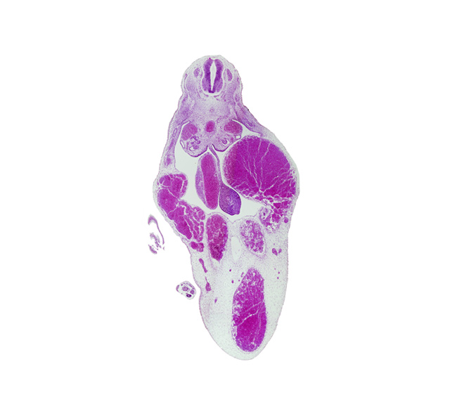 T-8 spinal ganglion, caudal eminence, dorsal mesentery, foot plate, left umbilical artery, left umbilical vein, midgut, right umbilical artery, right umbilical vein, superior mesenteric artery, umbilical cord, umbilical vein