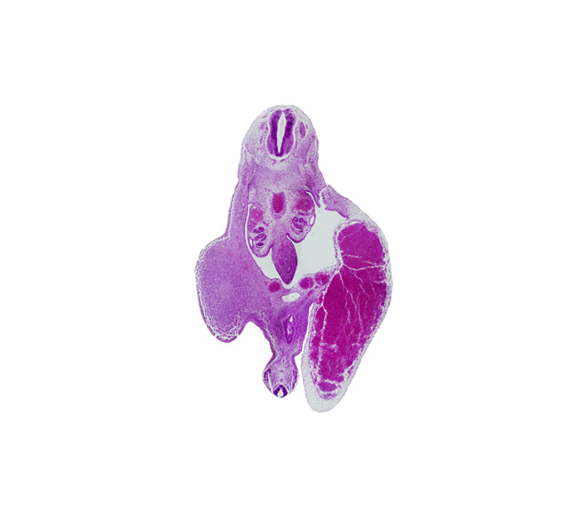 T-10 spinal ganglion, aorta, caudal part of primordial urogenital sinus, caudal part of tailgut, gonadal ridge, hindgut, left umbilical vein, lower limb (proximal part), mesonephric duct, mesonephros, primordial urogenital sinus