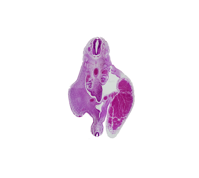 T-10 / T-11 interganglion region, aorta, artifact separation(s), central canal, dermatomyotome, junction of hindgut and primordial urogenital sinus, junction of mesonephric duct and urogenital sinus, left umbilical artery, mesonephric duct, mesonephric vesicle(s), notochord, peritoneal cavity, primordial urogenital sinus, right umbilical artery, roof plate, tail gut