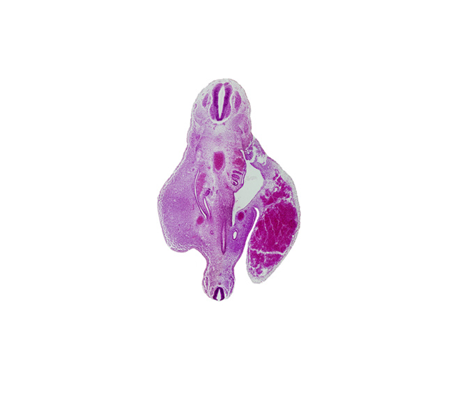 S-5 spinal ganglion, T-11 spinal ganglion, aorta, caudal edge of hindgut, caudal edge of mesonephric duct, caudal edge of peritoneal cavity, left umbilical vein (congested), mesonephric duct, metanephric diverticulum, peritoneal cavity, spinal cord