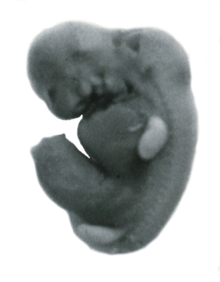 Left lateral view of the embryo prior to sectioning