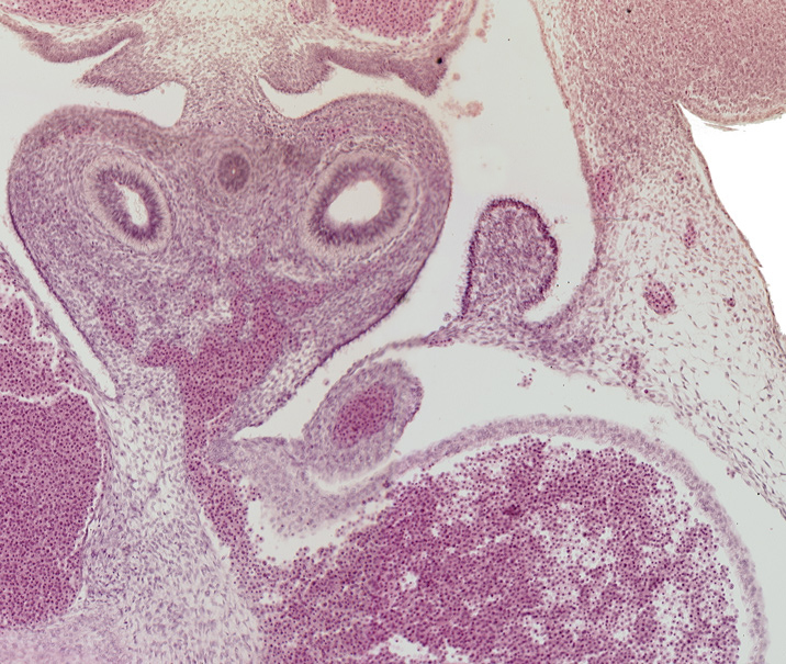 Mesenchymal tissue in the pulmonary and esophageal regions - Section