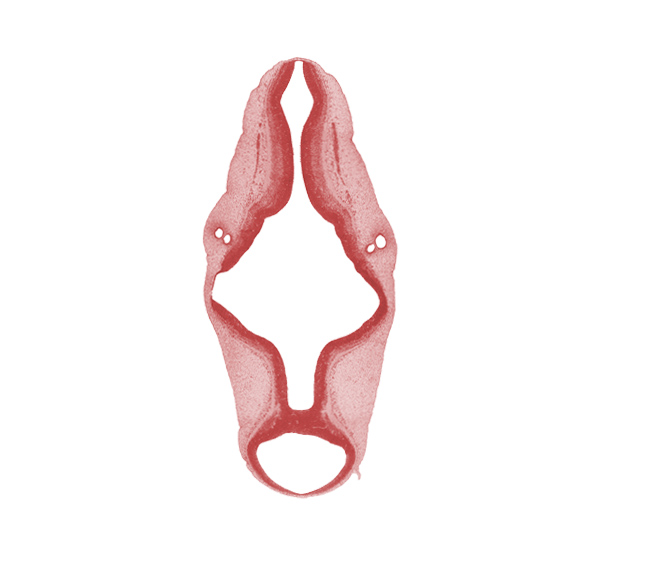 accessory nerve (CN XI), alar plate of metencephalon (cerebellum), alar plate(s), artifact separation(s), basal plate, cephalic edge of vagus nerve (CN X), intermediate zone, isthmus of rhombencephalon, marginal zone, mesencephalon (M2), mesencoel (cerebral aqueduct), metencephalon, myelencephalon, otic capsule, rhombencoel (fourth ventricle), rhombomere 5, rhombomere 6, roof plate, sulcus limitans, trochlear nerve (CN IV), ventricular zone