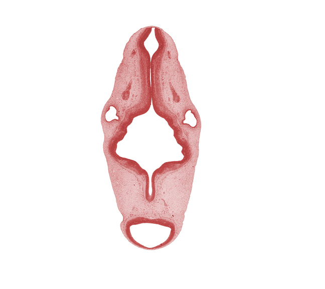 accessory nerve (CN XI), basal plate, central canal of myelencephalon, intermediate zone, marginal zone, median sulcus, mesencephalon (M1), oculomotor nerve (CN III), rhombomere 2, rhombomere 3, rhombomere 4, rhombomere 5, rhombomere 6, root of glossopharyngeal nerve (CN IX), sulcus limitans, superior ganglion of vagus nerve (CN X), trochlear nerve (CN IV), ventricular zone