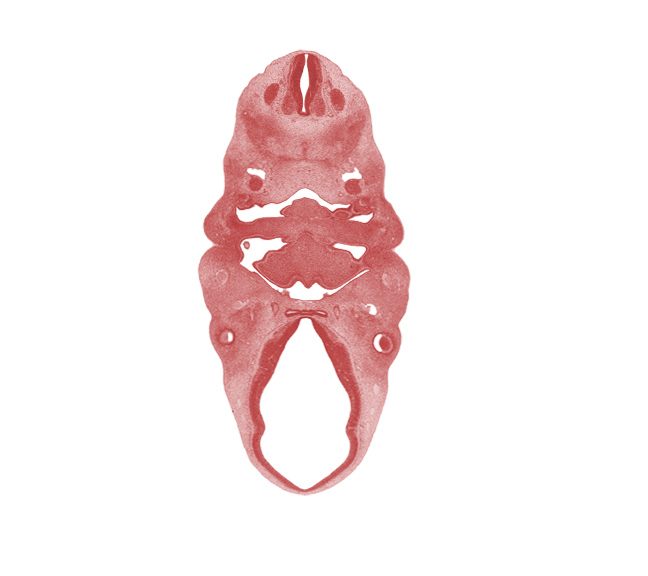 C-2 spinal ganglion, copula of tongue, dorsal sulcus, edge of neural layer of retina, epithalamus, extra-ocular premuscle mass, hypoglossal nerve (CN XII), hypopharyngeal eminence of tongue, inferior ganglion of vagus nerve (CN X), internal carotid artery, intraretinal space (optic vesicle cavity), lateral lingual swelling of tongue, marginal ridge, middle sulcus, oronasal cavity, pharyngeal groove 1, pharyngeal pouch 1, pharyngeal pouch 2, spinal accessory nerve (CN XI), sternocleidomastoid / trapezius premuscle mass, thyroglossal duct, tuberculum impar, ventral (hypothalamic) sulcus