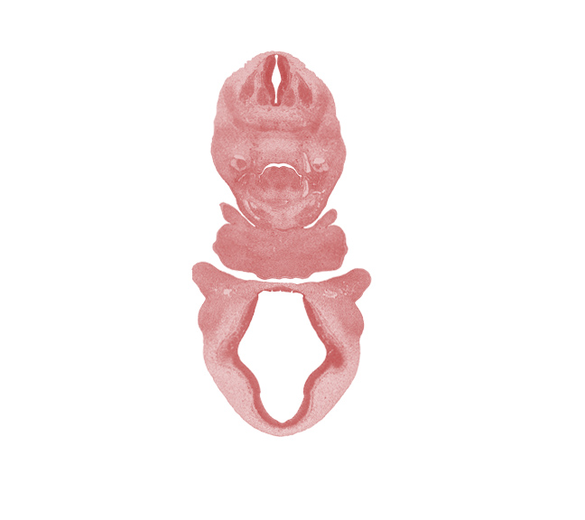 C-3 spinal ganglion, alar plate(s), aortic arch 6, aortic sac, basal plate, diencephalon, dorsal aorta, dorsal ramus, edge of cerebral vesicle (telencephalon), edge of lateral lingual swelling of tongue, edge of optic chiasma (chiasmatic plate), floor plate, laryngeal pharynx, mandibular prominence of pharyngeal arch 1, maxillary prominence of pharyngeal arch 1, maxillary venous plexus, nasomaxillary groove, pharyngeal arch 2, pharyngeal pouch 4, roof plate, sulcus limitans, third ventricle, transition region, transition region between telencephalon and diencephalon