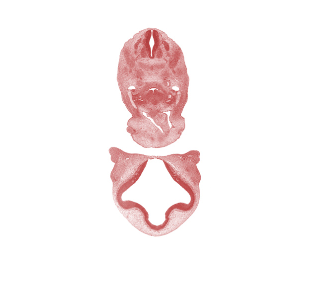 C-4 spinal ganglion, anterior cerebral artery, aortic arch 6, ascending aorta, dorsal aorta, edge of nasal sac epithelium, head mesenchyme, hypoglossal nerve (CN XII), interventricular foramen, junction of maxillary and medial nasal prominences, laryngeal pharynx, lateral ventricle, maxillary prominence of pharyngeal arch 1, medial nasal prominence(s), notochord, pharyngeal condensation, precardinal vein, primordial meninx, surface ectoderm, sympathetic trunk, third ventricle, torus hemisphericus, ultimopharyngeal pouch, vagus nerve (CN X), wall of truncus arteriosus (distal outflow tract)