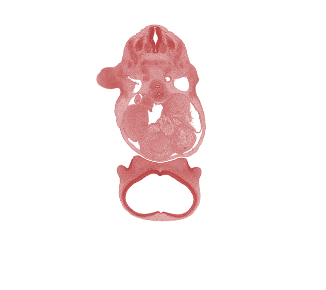 C-5 spinal ganglion, cephalic edge of upper limb, dorsal primary ramus, epaxial part of myotome, hypaxial part of myotome, interventricular foramen, junction of infundibulum and trabecular part of right ventricle, junction of precardinal and subclavian veins, left atrium, notochord, phrenic nerve, precardinal vein, primary interatrial septum (septum primum), right atrium, sinus venosus, sympathetic trunk, telencephalon medium, ventral primary ramus