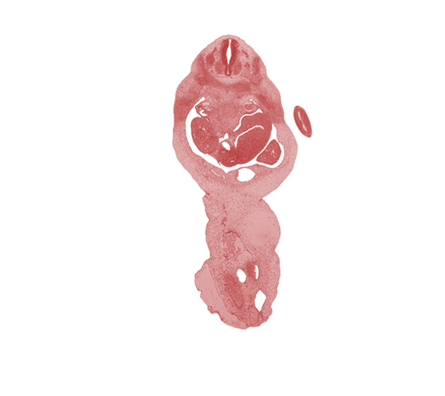 T-2 dorsal root, T-3 spinal nerve, T-3 ventral root, blastema of rib 4, cephalic edge of T-3 spinal ganglion, dorsal mesogastrium, duodenum, hepatic portal vein, left lobe of liver, left umbilical artery, lesser sac (omental bursa), marginal vein, mesonephric duct, neural arch, postcardinal vein, right lobe of liver, right umbilical artery, roof plate, spleen, umbilical cord, umbilical vein