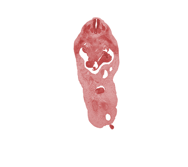 T-4 intercostal nerve, allantois, aorta, blastema of rib 5, duodenum, herniated midgut mesenchyme, involuting right umbilical vein, left umbilical artery, notochord, primordial filum terminale, right umbilical artery, rupture point of superior mesenteric vein, superior mesenteric artery, superior mesenteric vein, umbilical coelom, umbilical vein